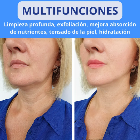 LIMPIADOR FACIAL PRO™